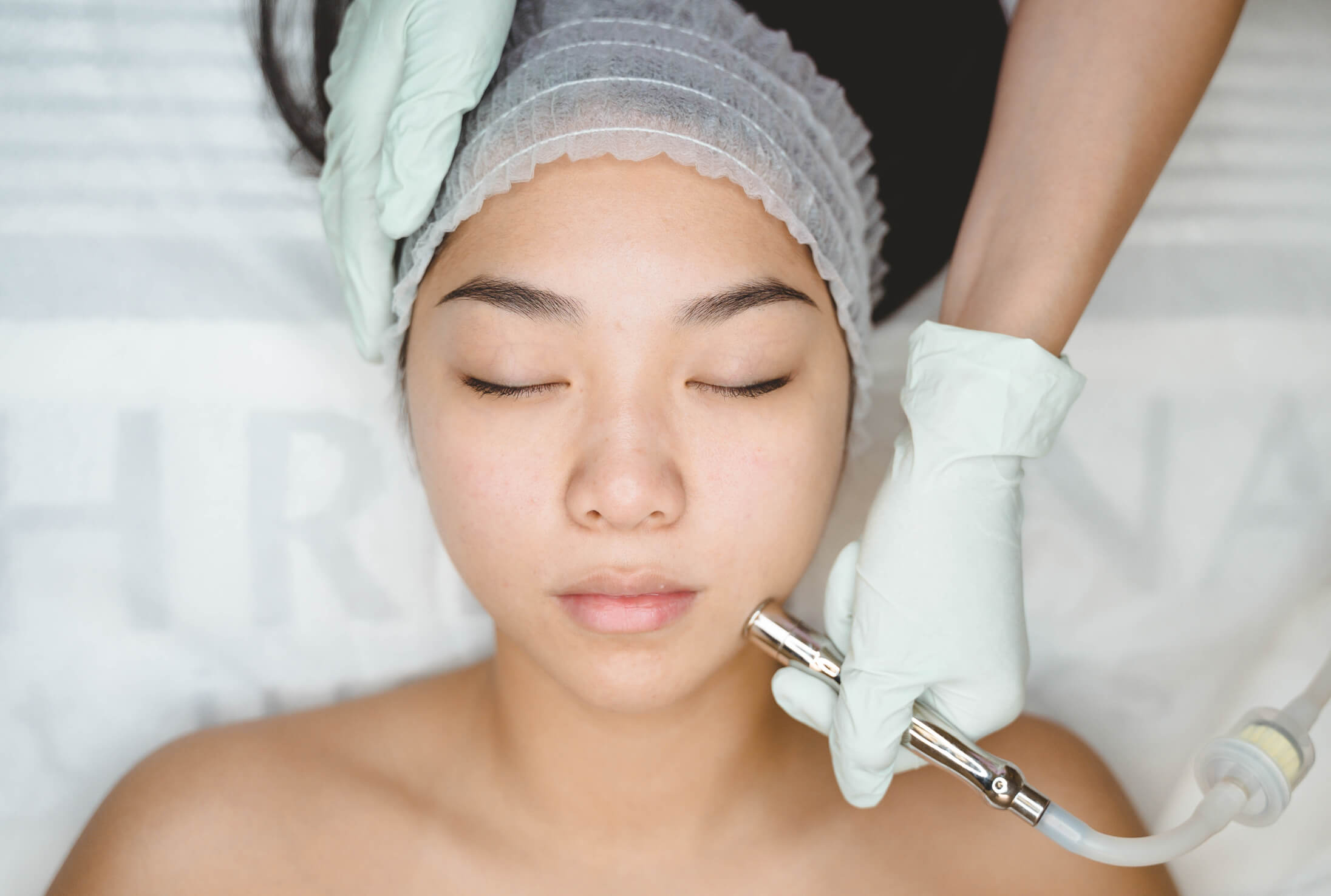microdermabrasion